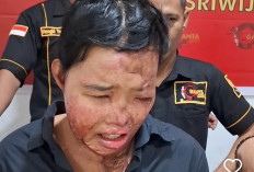 Sudah Jatuh Tertimpa Tangga: Suryani, Korban Air Keras Banyuasin Terlilit Utang Ratusan Juta!