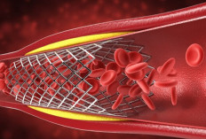 Penting! Ini 7 Tanda Tubuh Mengalami Penyumbatan Pembuluh Darah
