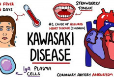 Panduan Orang Tua: Cara Mengenali Kawasaki Disease Sejak Dini