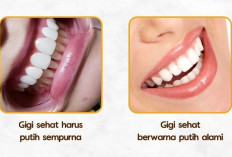 8 Tips Menjaga Kesehatan Gigi dan Mulut