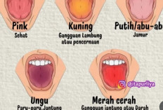 Kenali Warna Lidah Anda: Tanda-Tanda Kesehatan yang Perlu Diwaspadai