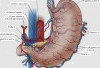 Gastric Ischemia: Penyakit Langka yang Menyerang Pebulutangkis China, Ini Penjelasannya